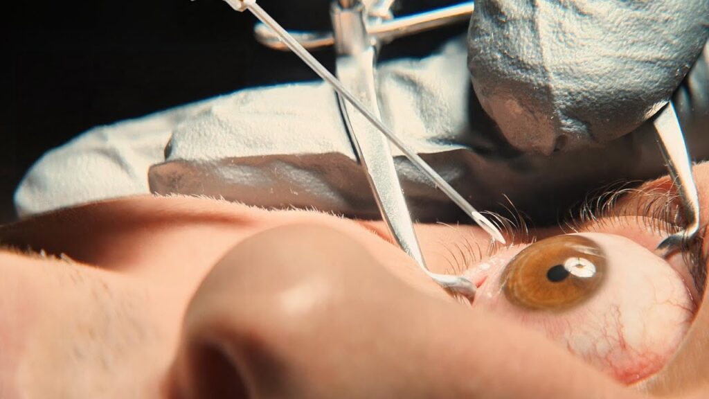 The Home: A chilling ritual where eye fluid is drained to grant eternal youth in a cursed home