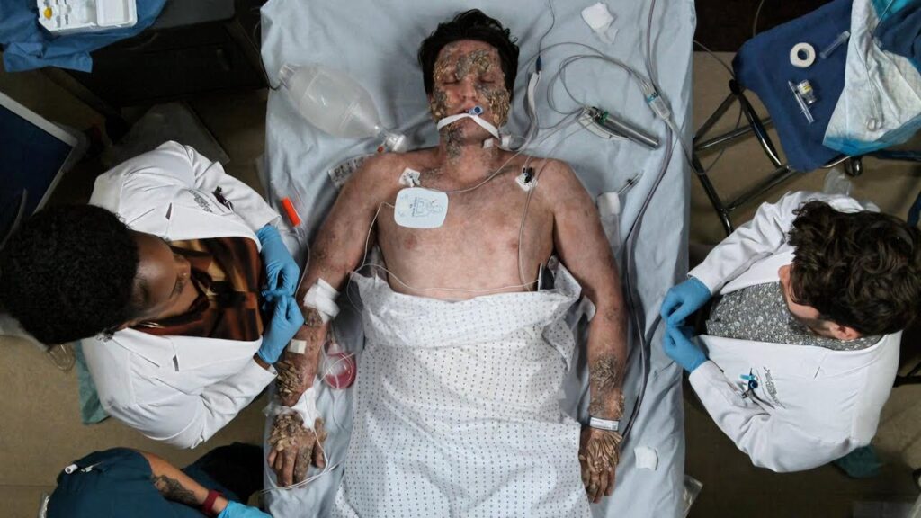 The Good Doctor S6P3: Bark Skin Disease Gives Doctors An Unprecedented Challenge