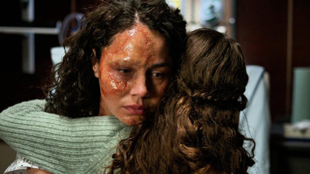 The Good Doctor S5P2: Mom Is Disfigured Scaring Her Daughter So Shaun Fixes Face With Water Knife